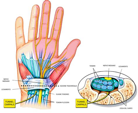 tudor per tunnel carpale|carpal tunnel syndrome pdf.